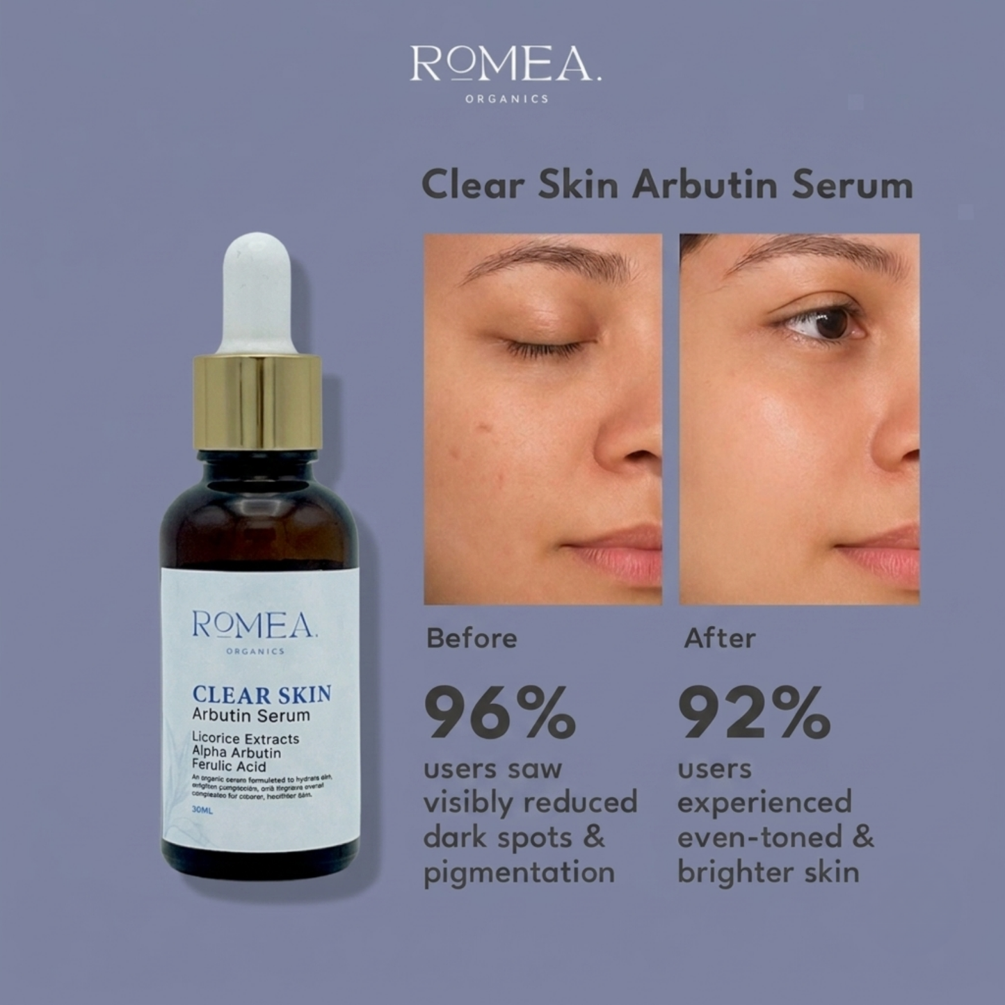 Clear Skin Arbutin Serum