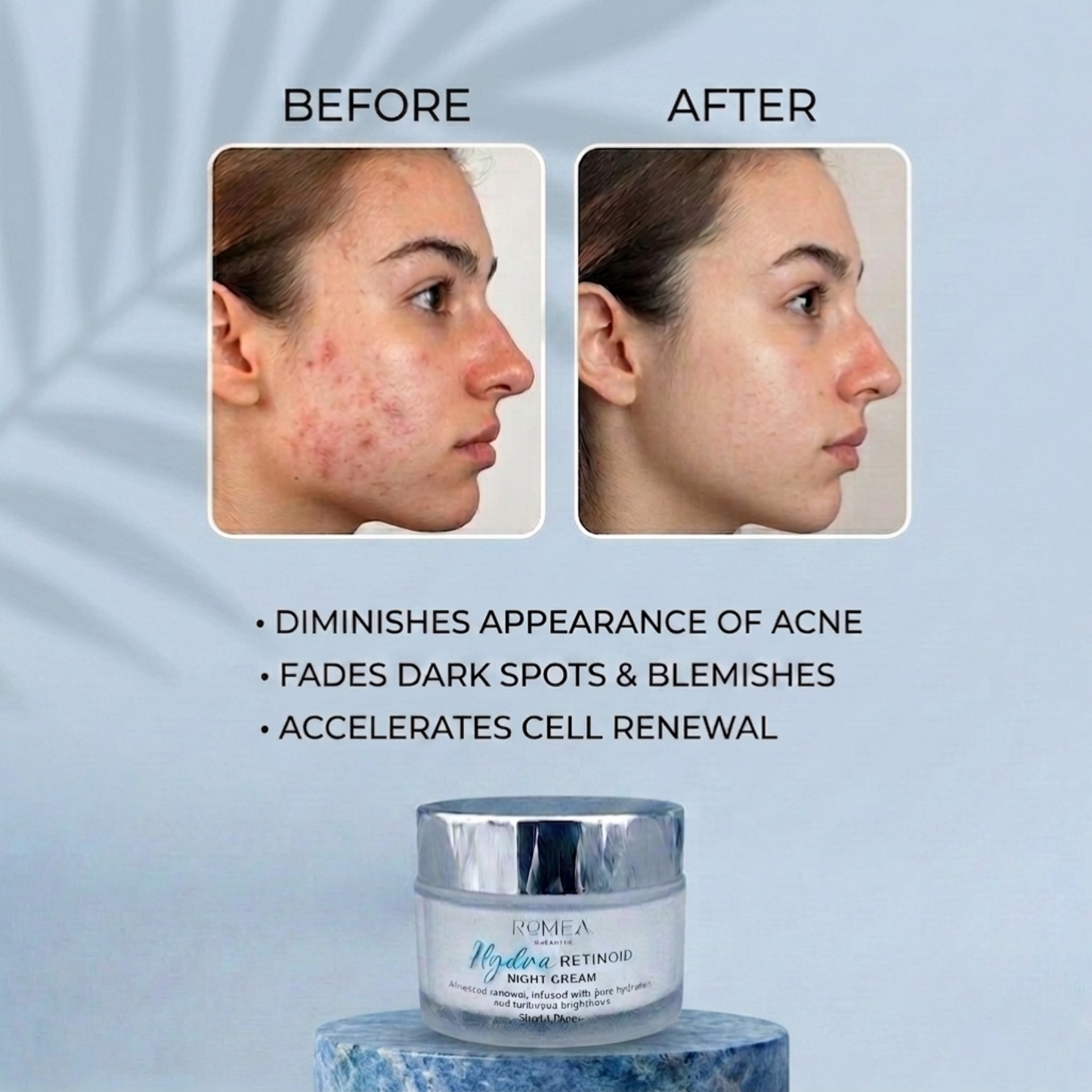 Hydra Retinoid Night Cream