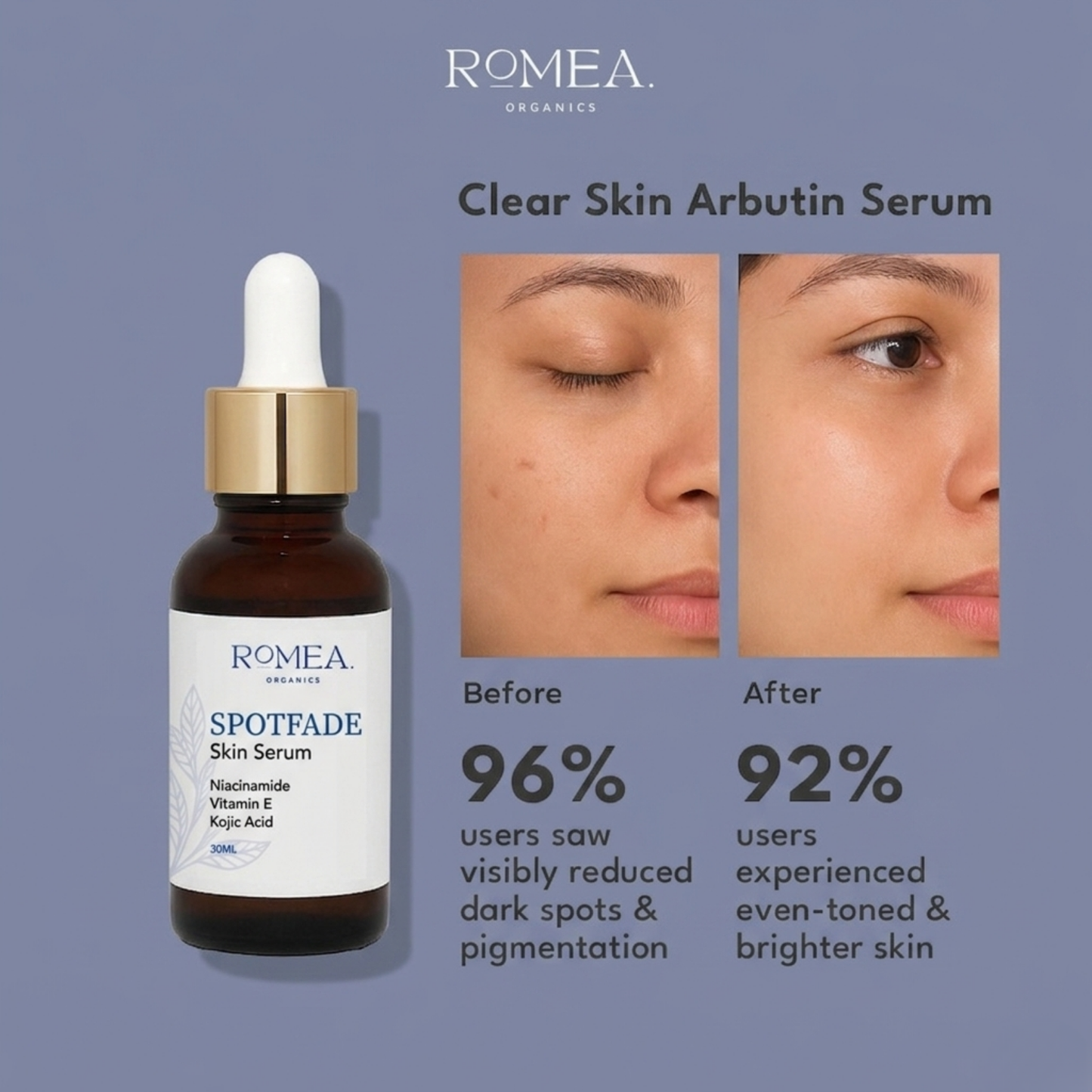 Clear Skin Arbutin Serum